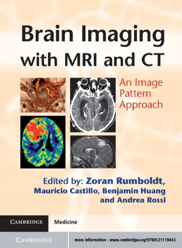Brain Imaging with MRI and CT: An Image Pattern Approach