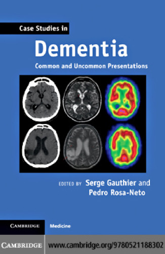 Case Studies in Dementia: Common and Uncommon Presentations