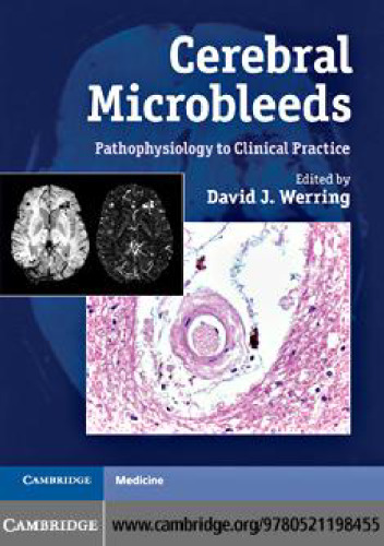 Cerebral Microbleeds: Pathophysiology to Clinical Practice
