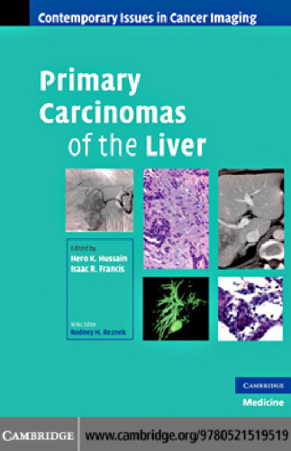 Primary Carcinomas of the Liver (Contemporary Issues in Cancer Imaging)