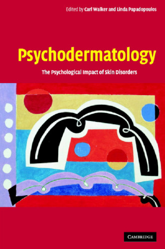 Psychodermatology: The Psychological Impact of Skin Disorders