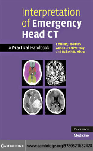 Interpretation of Emergency Head CT: A Practical Handbook