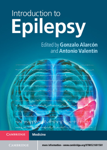 Introduction to Epilepsy