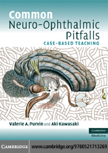 Common Neuro-Ophthalmic Pitfalls (Case-Based Teaching)