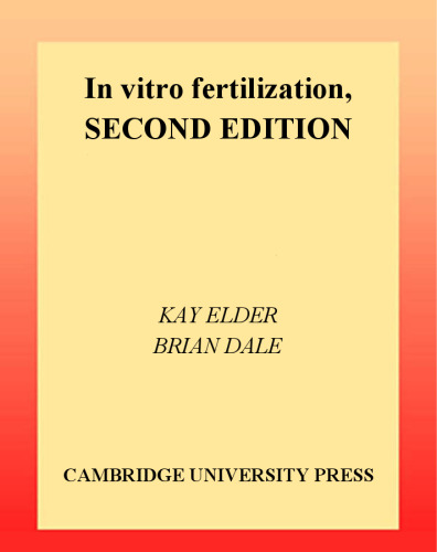 In Vitro Fertilization