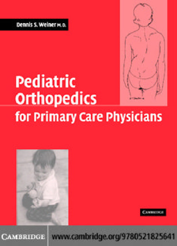 Pediatric orthopedics for primary care physicians