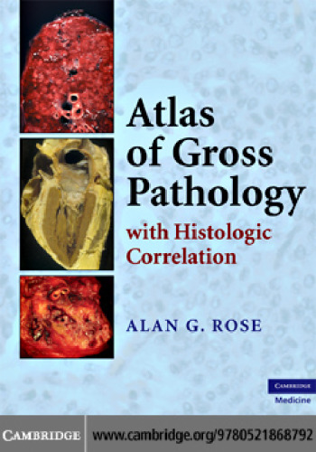 Atlas of Gross Pathology: With Histologic Correlation