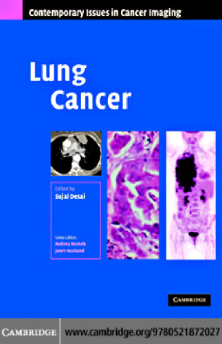 Lung Cancer