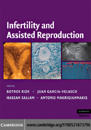Infertility and Assisted Reproduction