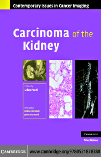 Carcinoma of the Kidney