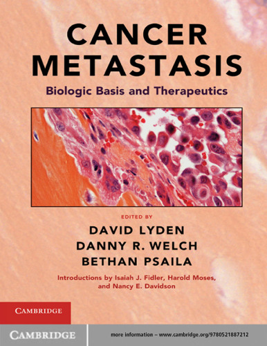 Cancer Metastasis: Biologic Basis and Therapeutics