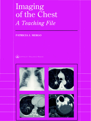 Imaging of the Chest: A Teaching File