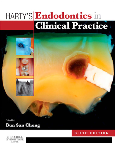 Harty's Endodontics in Clinical Practice, 6e