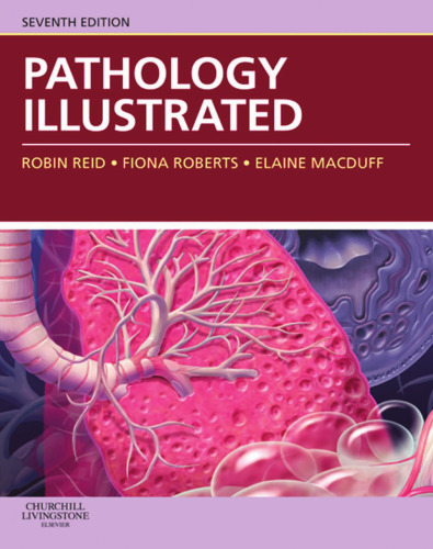Pathology Illustrated
