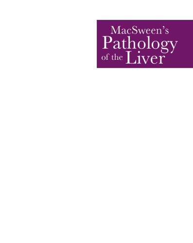 Macsween's Pathology of the Liver: Expert Consult: Online and Print