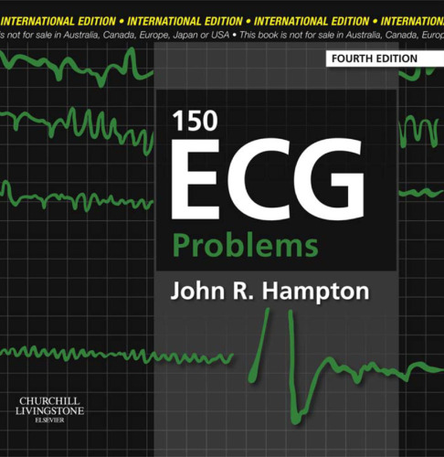 150 ECG problems