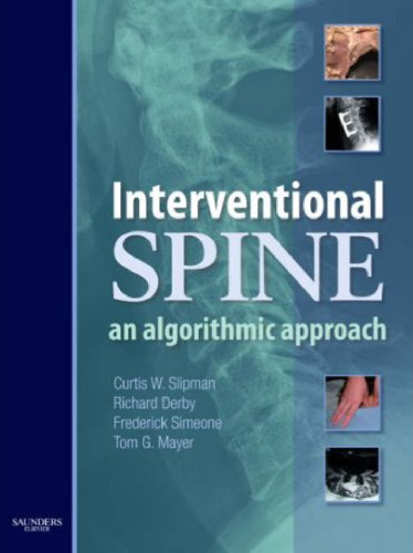 Interventional Spine: An Algorithmic Approach
