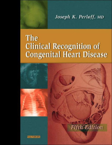 Clinical Recognition of Congenital Heart Disease, 5Th Edition