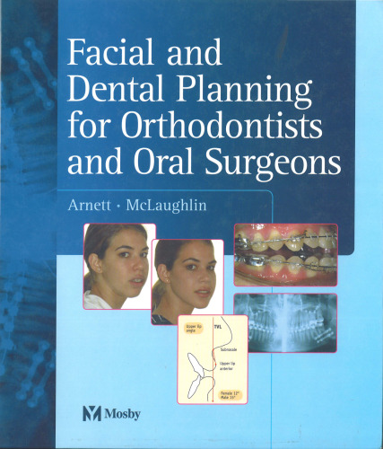 Facial and Dental Planning for Orthodontists and Oral Surgeons1