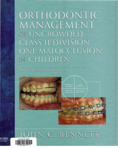 Orthodontic Management of Uncrowded Class II Division One Malocclusion in Children