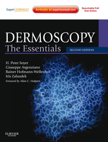 Dermoscopy: The Essentials: Expert Consult - Online and Print, 2e