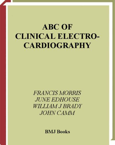 ABC of clinical electrocardiography
