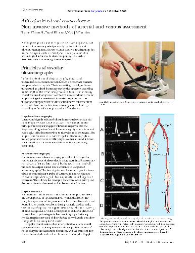 ABC of Arterial and Venous Disease