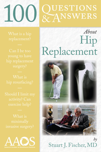 100 Questions & Answers About Hip Replacement