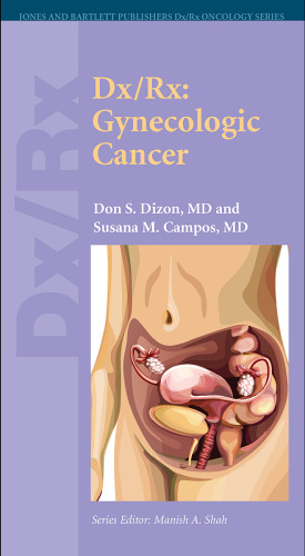 Dx Rx: Gynecologic Cancer (Jones and Bartlett Publishers Dx Rx Oncology Series)
