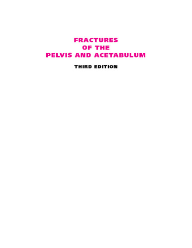 Fractures of the Pelvis and Acetabulum
