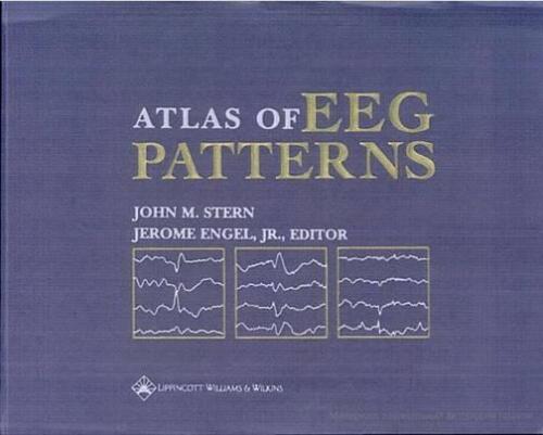 An Atlas of EEG Patterns