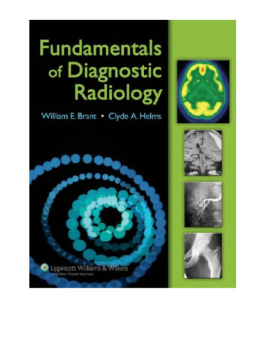 The Brant and Helms Solution: Fundamentals of Diagnostic Radiology, Third Edition (Brant, Fundamentals of Diagnostic Radiology)