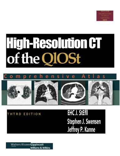 High-Resolution CT of the Chest: Comprehensive Atlas