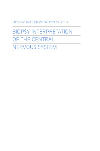 Biopsy Interpretation of the Central Nervous System