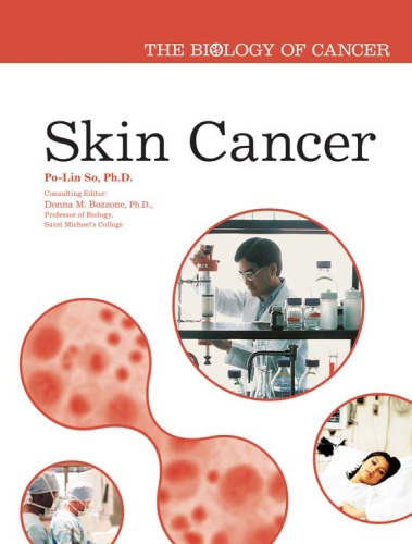 Skin Cancer (The Biology of Cancer)