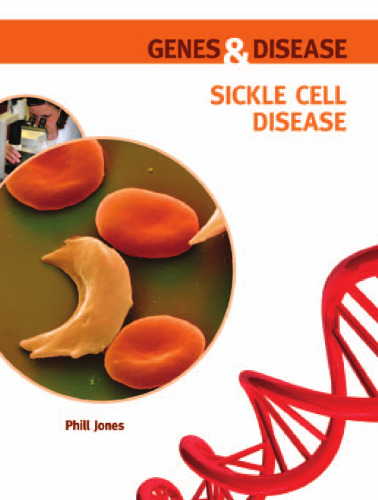 Sickle Cell Disease (Genes and Disease)