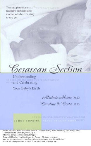 Cesarean Section: Understanding and Celebrating Your Baby’s Birth