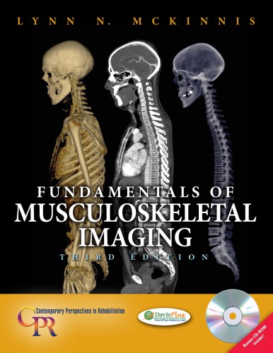 Fundamentals of Musculoskeletal Imaging, 3rd Edition (Contemporary Perspectives in Rehabilitation)