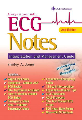 ECG Notes: Interpretation and Management Guide, Second Edition