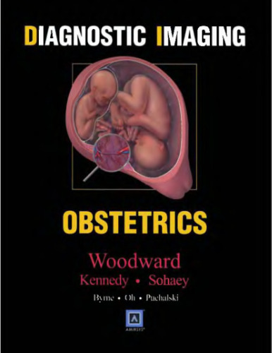 Diagnostic Imaging: Obstetrics