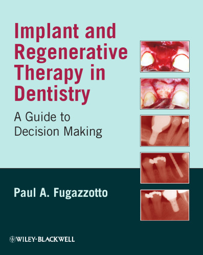 Implant and Regenerative Therapy in Dentistry: A Guide to Decision Making