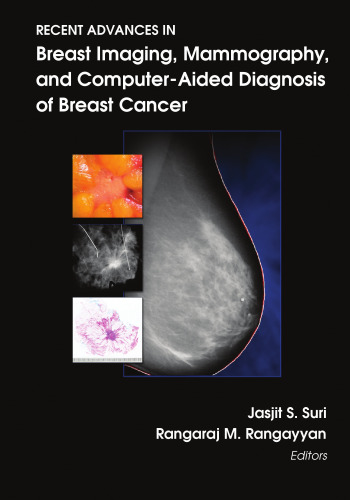 Recent Advances in Breast Imaging, Mammography, and Computer-Aided Diagnosis of Breast Cancer