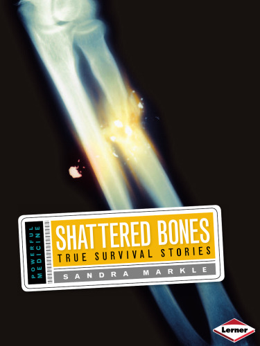 Shattered Bones: True Survival Stories ()