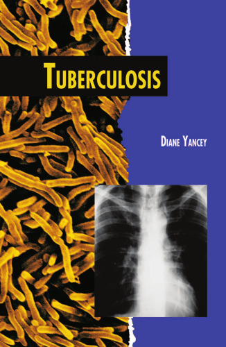 Tuberculosis (Twenty-First Century Medical Library)