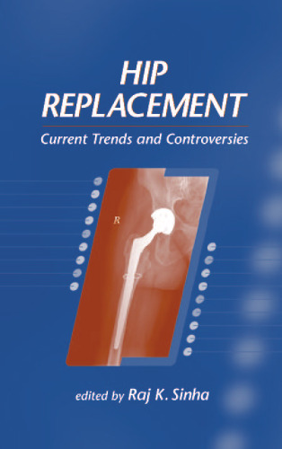 Hip replacement : current trends and controversies