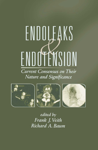 Endoleaks and Endotension: Current Consensus on Their Nature and Significance
