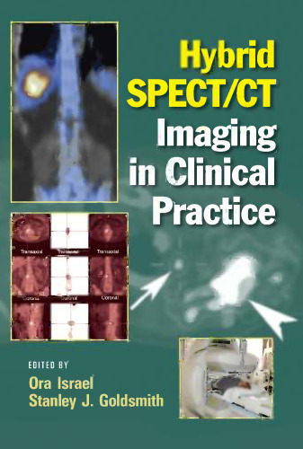 Hybrid SPECT/CT imaging in clinical practice