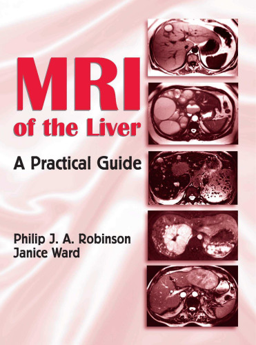 MRI of the Liver: A Practical Guide