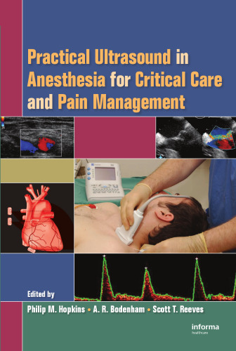 Practical Ultrasound in Anesthesia for Critical Care and Pain Management