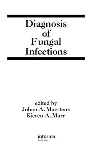 Diagnosis of Fungal Infections (Infectious Disease and Therapy)